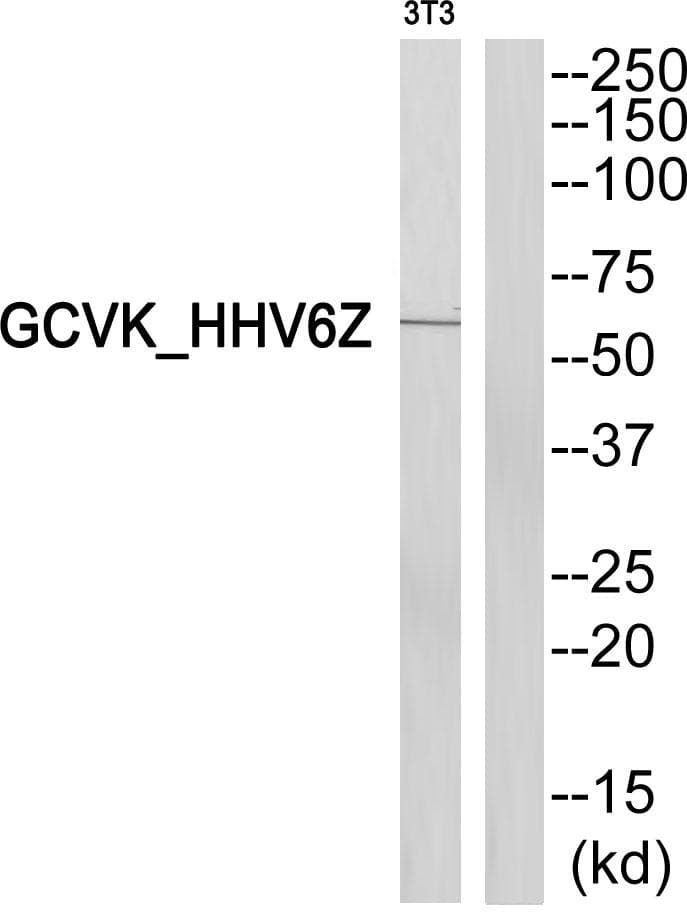 Polyclonal Rabbit anti-Human MAP2K3 / MEK3 / MKK3 Antibody (WB)