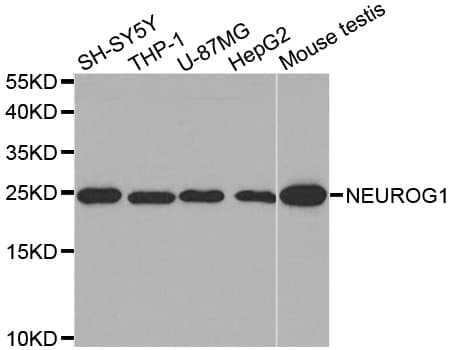 Polyclonal Rabbit anti-Human NEUROG1 / NGN1 / Neurogenin 1 Antibody (IHC, WB)