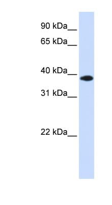 Polyclonal Rabbit anti-Human GPD1L Antibody (C-Terminus, WB)