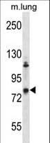 ADRBK2 / GRK3 Antibody (aa524-552)
