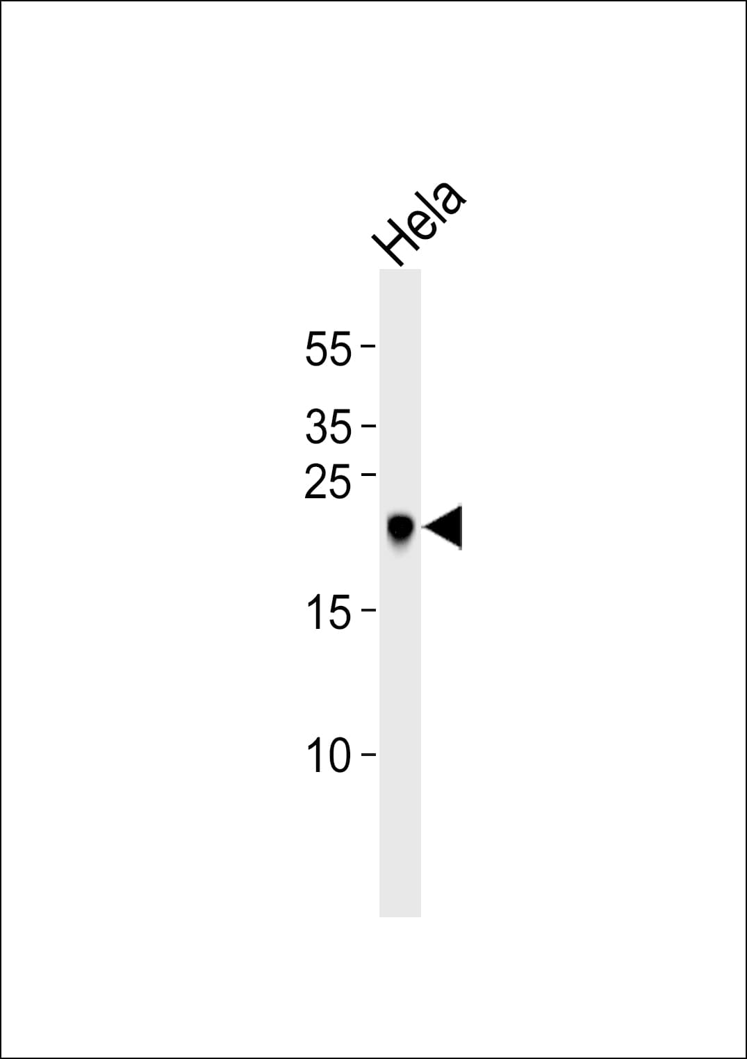 PARK7 / DJ-1 Antibody (aa130-164)
