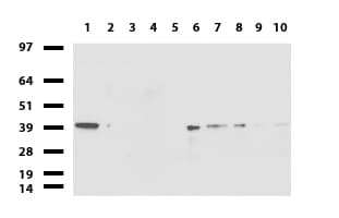 ERCC1 Antibody (clone 4F9)