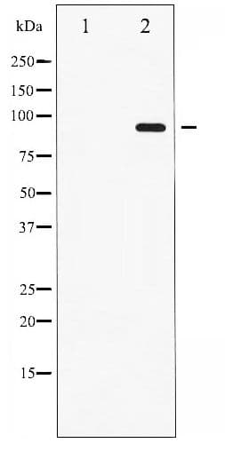 STAT6 Antibody (phospho-Thr645)
