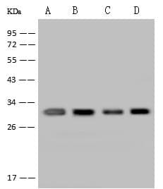 RAP30 / GTF2F2 Antibody