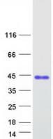 Human VCX3A Protein (Recombinant Myc-DDK (Flag))