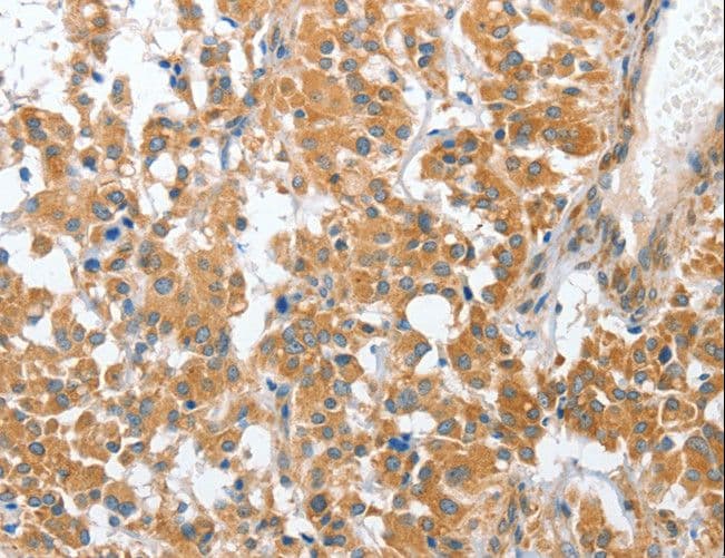 Polyclonal Rabbit anti-Human CHMP4B Antibody (IHC)