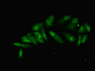 Polyclonal Rabbit anti-Human HNRNPL / hnRNP L Antibody (aa89-335, IHC)