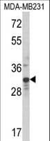 Polyclonal Rabbit anti-Human MLX / TCFL4 Antibody (aa125-151, IHC, WB)