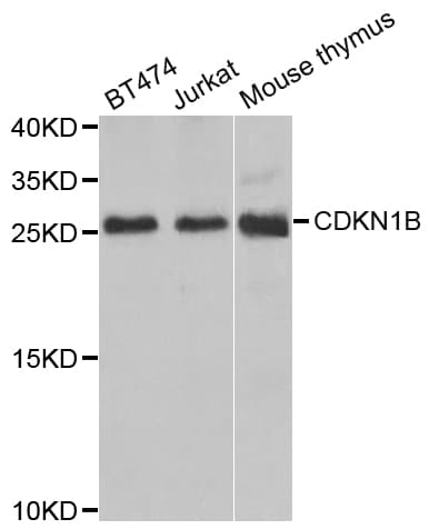 Polyclonal Rabbit anti-Human CDKN1B / p27 Kip1 Antibody (IHC, IF, WB)