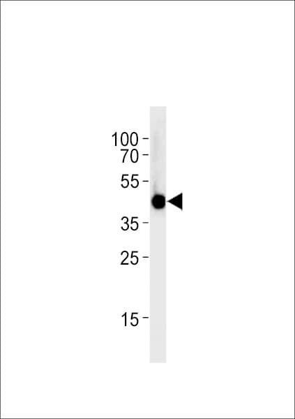 irf2bp2a Antibody (aa238-260)