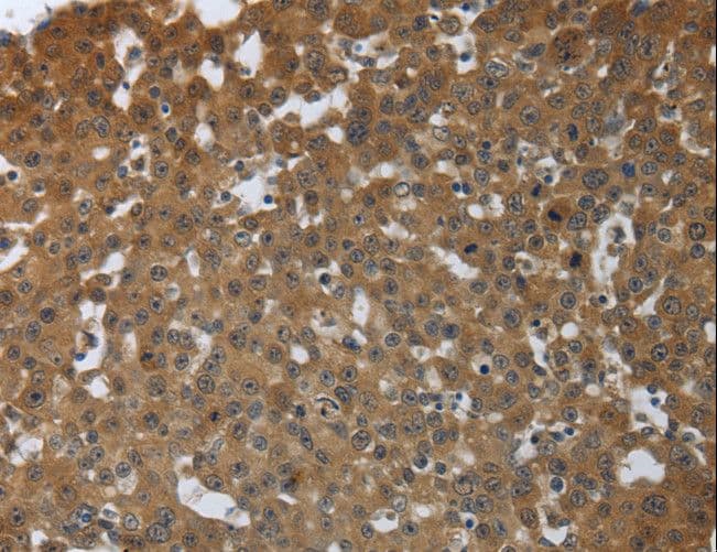 PTPRM / PTP Mu Antibody