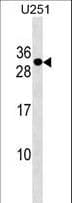 Polyclonal Rabbit anti-Human POMZP3 Antibody (aa1-30, WB)