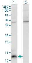 CCL7 / MCP3 Antibody (clone 4B5)