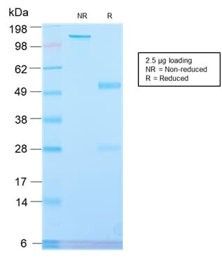 PLAP / Alkaline Phosphatase Antibody (clone ALPP/2899R, Azide-free, Carrier-free)