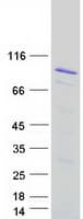 Human Zyxin Protein (Recombinant Myc-DDK (Flag))