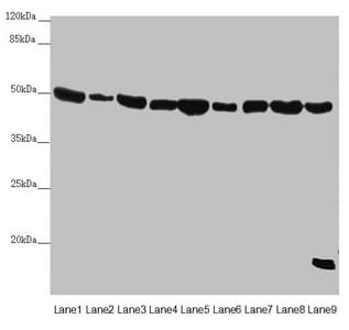 EF1G / EEF1G Antibody