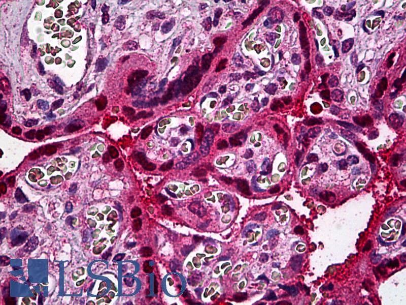 IHC-plus™ STAT5B Antibody (clone 2D1)