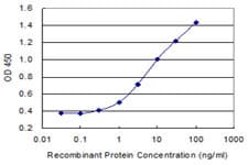 PDYN / ProDynorphin Antibody (clone 2E12)