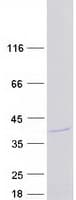 Human ATP6E / ATP6V1E1 Protein (Recombinant Myc-DDK (Flag))