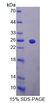 Rat IFNA2 / Interferon Alpha 2 Protein (Recombinant His-T7)