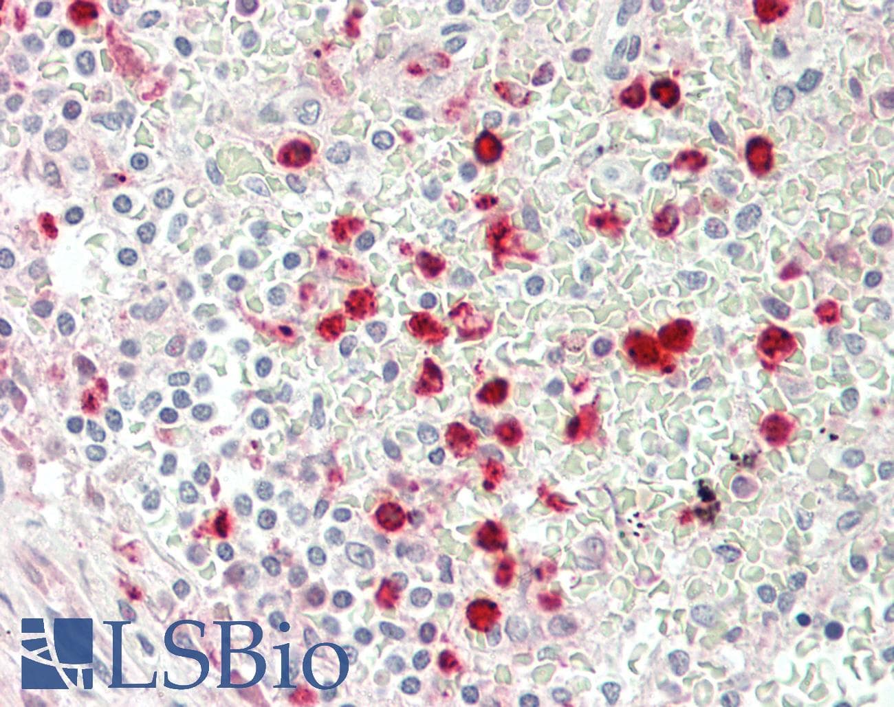 IHC-plus™ LYZ / Lysozyme Antibody