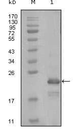 Monoclonal Mouse anti-Human HAND1 Antibody (clone 8E7A11, WB)
