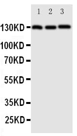 CD144 / CDH5 / VE Cadherin Antibody (aa766-784)