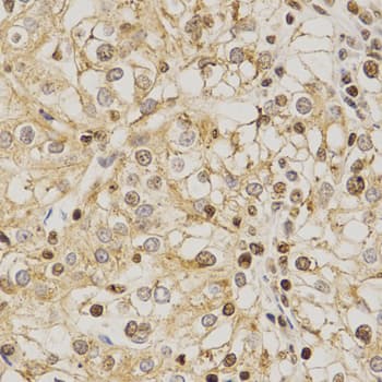 Polyclonal Rabbit anti-Human PDE4D Antibody (IHC, WB)