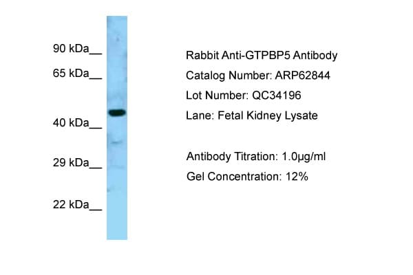 MTG2 / GTPBP5 Antibody (aa130-179)