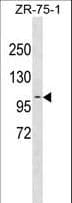 Polyclonal Rabbit anti-Human PDCD6IP / ALIX Antibody (aa541-570, WB)