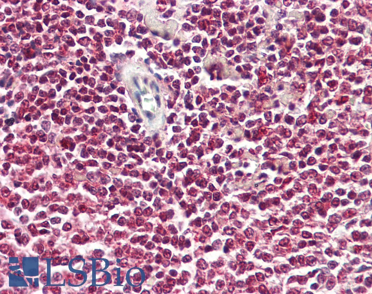 NF90 / ILF3 Antibody (N-Terminus)