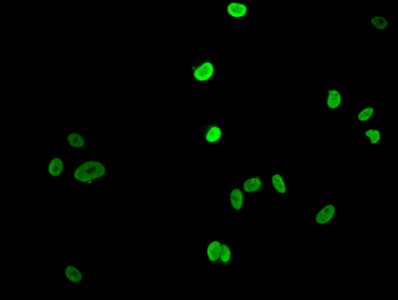 HIST1H1E Antibody