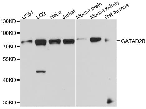 Polyclonal Rabbit anti-Human GATAD2B Antibody (WB)