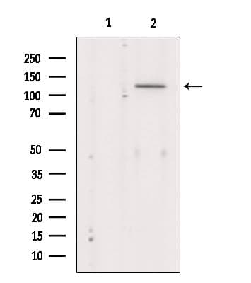 Polyclonal Rabbit anti-Human KCNMA1 / BK Antibody (IHC, WB)