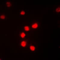 Polyclonal Rabbit anti-Human ZNF682 Antibody (N-Terminus, IF, WB)