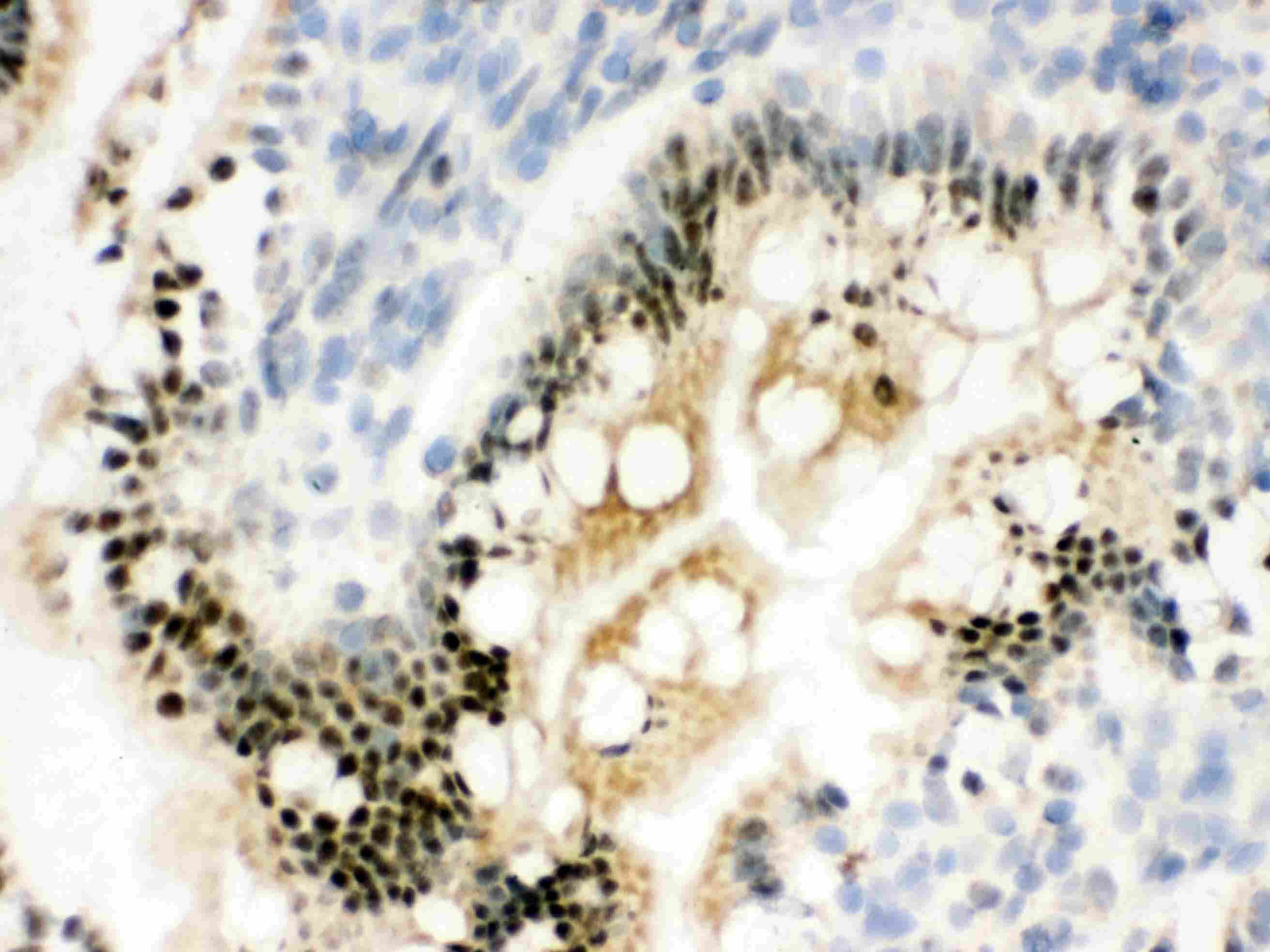 RBBP4 / RBAP48 Antibody (aa395-425)