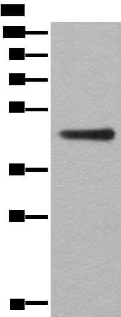 Polyclonal Rabbit anti-Human ASS1 / ASS Antibody (WB)