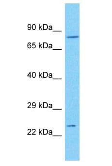 CENPK Antibody (aa75-124)
