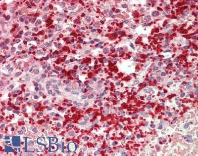IHC-plus™ Polyclonal Rabbit anti-Human F13A1 / Factor XIIIa Antibody (N-Terminus, IHC, WB)