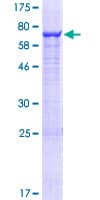 Human MINA / MINA53 Protein (Recombinant GST)