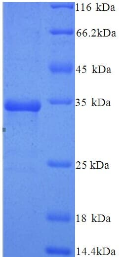 Human AGO2 / EIF2C2 Protein (Recombinant His)