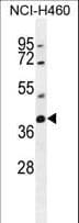 TECRL Antibody (aa325-354)
