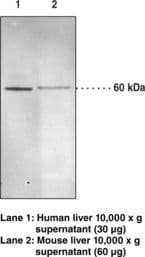 IHC-plus™ EPHX2 / Epoxide Hydrolase 2 Antibody