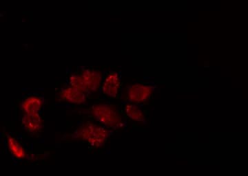 PIBF1 / PIBF Antibody