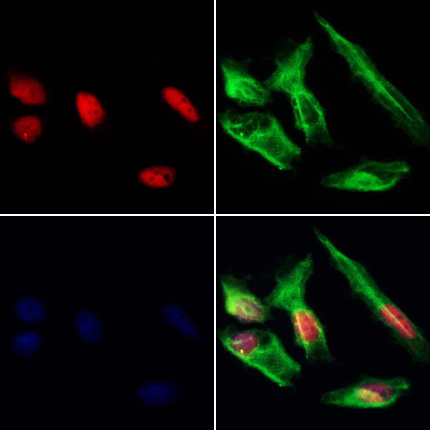 HDGFRP3 Antibody