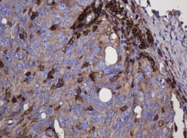 FNDC4 Antibody (clone OTI1B7)