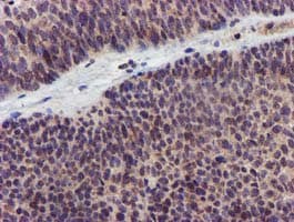 KCNAB1 Antibody (clone OTI7F12, Carrier-free)