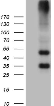 GRM4 / MGLUR4 Antibody (aa126-407, clone OTI6D1, Carrier-free)