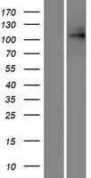TPC1 / TPCN1 Protein (Over-Expression Lysate Myc-DDK (Flag))
