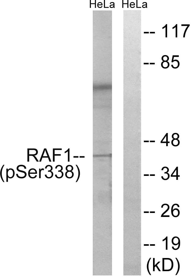RAF1 / RAF Antibody (phospho-Ser338)